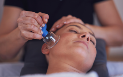 Face-Cupping: Saugnäpfe als Anti-Aging-Trend