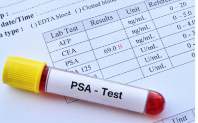 PSA-Test: Patientenorientierte Betrachtung und Nutzen