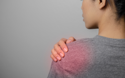 Schulterschmerzen verstehen: Das Impingement-Syndrom